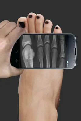 X_Ray Scanner android App screenshot 4