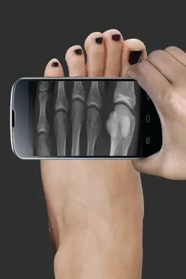 X_Ray Scanner android App screenshot 6